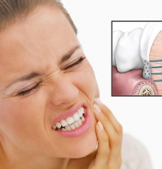 Come combattere la sensibilità Dentale